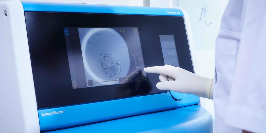 EmbryoScope - jak zwiększyć szanse powodzenia in vitro?